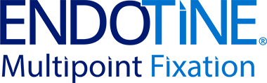 ENDOTINE® Multipoint Fixation